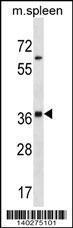 Anti-INHA Rabbit Polyclonal Antibody (PE (Phycoerythrin))