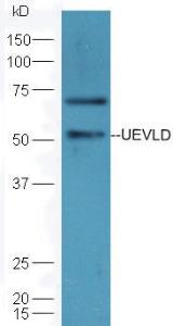 Anti-UEVLD Rabbit Polyclonal Antibody