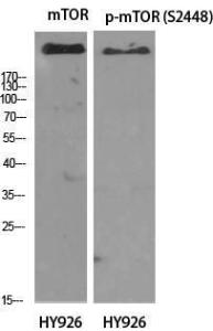 Western blot analysis of various cells using Anti-mTOR (phospho Ser2448) Antibody