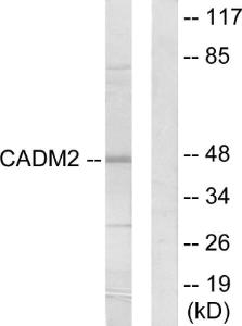 Western blot analysis of lysates from HepG2 cells using Anti-CADM2 Antibody. The right hand lane represents a negative control, where the antibody is blocked by the immunising peptide.