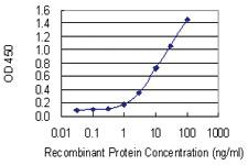 Anti-NOCT Mouse Monoclonal Antibody [clone: 3E8]