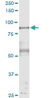 Anti-PFKP Polyclonal Antibody Pair