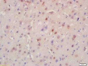 Anti-BRD8 Rabbit Polyclonal Antibody