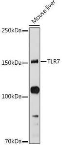 Western blot analysis of extracts of Mouse liver, using Anti-TLR7 Antibody (A12749) at 1:1,000 dilution. The secondary antibody was Goat Anti-Rabbit IgG H&L Antibody (HRP) at 1:10,000 dilution.