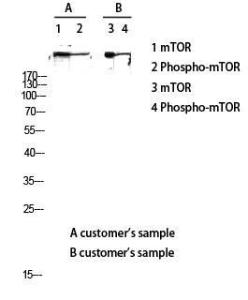 Western blot analysis of customer's lysis using Anti-mTOR (phospho Ser2448) Antibody