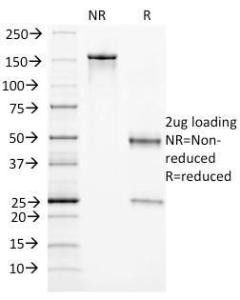 SDS-PAGE analysis of Anti-CD105 Antibody [ENG/1327] under non-reduced and reduced conditions; showing intact IgG and intact heavy and light chains, respectively. SDS-PAGE analysis confirms the integrity and purity of the antibody