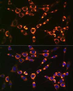 Immunofluorescence analysis of NIH-3T3 cells using Anti-PBR Antibody [ARC0308] (A305742) at a dilution of 1:100 (40X lens). DAPI was used to stain the cell nuclei (blue)