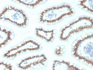 Immunohistochemical analysis of formalin-fixed, paraffin-embedded human small intestine using Anti-HNF1 alpha Antibody [HNF1A/2087]