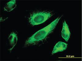 Anti-CK18 Mouse Monoclonal Antibody [clone: 2F8]