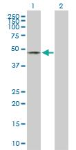 Anti-EOGT Mouse Polyclonal Antibody