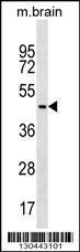 Anti-FAF2 Rabbit Polyclonal Antibody (AP (Alkaline Phosphatase))