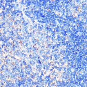 Immunohistochemistry analysis of paraffin-embedded rat thymus using Anti-CCXCR1/XCR1 Antibody (A307294) at a dilution of 1:100 (40X lens). Perform microwave antigen retrieval with 10 mM Tris/EDTA buffer pH 9.0 before commencing with IHC staining protocol