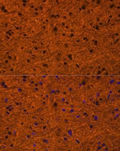 Anti-PMCA1 Rabbit Polyclonal Antibody