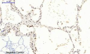 Immunohistochemical analysis of paraffin-embedded human lung tissue using Anti-mTOR (phospho Ser2448) Antibody at 1:200 (4°C overnight). Negative control was secondary antibody only.