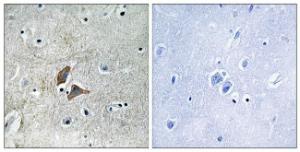 Immunohistochemical analysis of paraffin-embedded human brain using Anti-OMG Antibody. The right hand panel represents a negative control, where the antibody was pre-incubated with the immunising peptide.