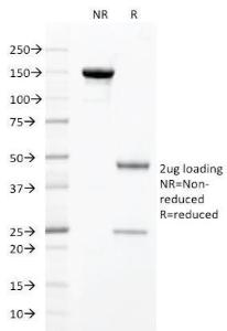 SDS-PAGE analysis of Anti-HNF1 alpha Antibody [HNF1A/2087] under non-reduced and reduced conditions; showing intact IgG and intact heavy and light chains, respectively. SDS-PAGE analysis confirms the integrity and purity of the antibody