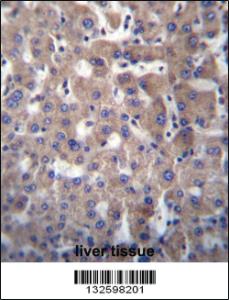 Anti-GGT2 Rabbit Polyclonal Antibody