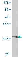 Anti-ETNK1 Mouse Polyclonal Antibody