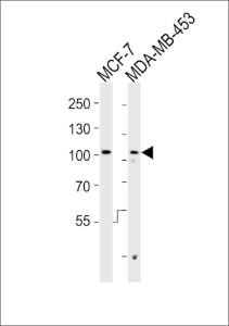 Anti-AFAP1 Rabbit Polyclonal Antibody