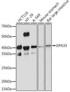 Western blot analysis of extracts of various cell lines, using Anti-GPA33 Antibody [ARC2060] (A308311) at 1:1000 dilution