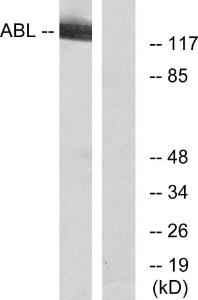 Western blot analysis of lysates from RAW264.7 cells using Anti-c-Abl Antibody. The right hand lane represents a negative control, where the antibody is blocked by the immunising peptide.