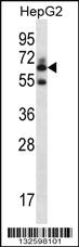 Anti-GGT2 Rabbit Polyclonal Antibody