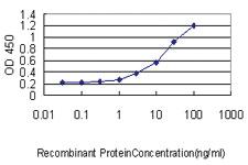 Anti-CK18 Mouse Monoclonal Antibody [clone: 2F8]