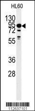 Anti-DYRK1A Rabbit Polyclonal Antibody (Biotin)