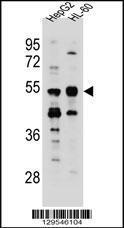 Anti-TEKT5 Rabbit Polyclonal Antibody (HRP (Horseradish Peroxidase))