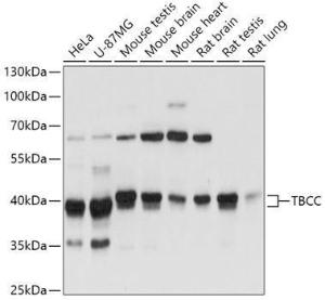 Anti-TBCC Rabbit Polyclonal Antibody