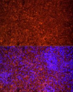 Immunofluorescence analysis of rat spleen cells using Anti-TLR7 Antibody (A12749) at a dilution of 1:20 (40x lens). DAPI was used to stain the cell nuclei (blue).