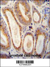 Anti-WFDC12 Rabbit Polyclonal Antibody (AP (Alkaline Phosphatase))