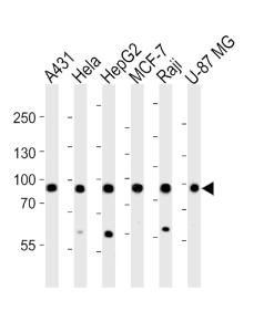 Anti-IMMT Rabbit Polyclonal Antibody