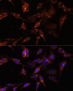 Anti-TBCC Rabbit Polyclonal Antibody