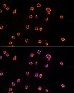 Immunofluorescence analysis of THP-1 cells using Anti-TLR7 Antibody (A12749) at a dilution of 1:20 (40x lens). DAPI was used to stain the cell nuclei (blue).