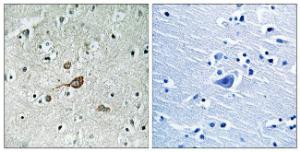 Immunohistochemical analysis of paraffin-embedded human brain tissue using Anti-c-Abl Antibody. The right hand panel represents a negative control, where the antibody was pre-incubated with the immunising peptide.