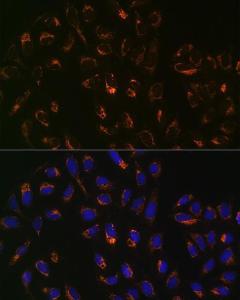 Immunofluorescence analysis of U-2 OS cells using Anti-PBR Antibody [ARC0308] (A305742) at a dilution of 1:100 (40X lens). DAPI was used to stain the cell nuclei (blue)