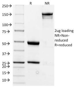 SDS-PAGE analysis of Anti-CD20 Antibody [L26] under non-reduced and reduced conditions; showing intact IgG and intact heavy and light chains, respectively. SDS-PAGE analysis confirms the integrity and purity of the antibody.