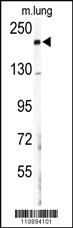 Anti-COL5A2 Rabbit Polyclonal Antibody