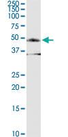 Anti-FOXP3 Rabbit Polyclonal Antibody