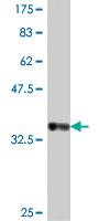 Anti-PBX1 Mouse Polyclonal Antibody