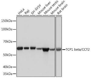 Western blot analysis of extracts of various cell lines, using Anti-CCT2 Antibody [ARC1097] (A307296) at 1:1,000 dilution