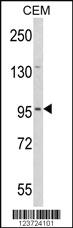 Anti-MYL3 Rabbit Polyclonal Antibody