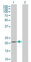 Anti-PRDX5 Mouse Polyclonal Antibody