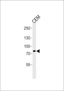 Anti-ACAP3 Rabbit Polyclonal Antibody