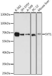 Western blot analysis of extracts of various cell lines, using Anti-Synaptotag min Antibody (A12750) at 1:1000 dilution. The secondary Antibody was Goat Anti-Rabbit IgG H&L Antibody (HRP) at 1:10000 dilution. Lysates/proteins were present at 25 µg per lane