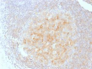 Anti-CD40 Mouse Monoclonal Antibody [Clone: C40/1605]