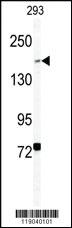 Anti-BCOR Rabbit Polyclonal Antibody