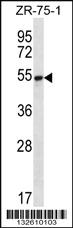 Anti-SEC62 Rabbit Polyclonal Antibody