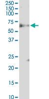 Anti-FBXW12 Mouse Monoclonal Antibody [clone: 1A9]